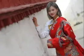 少年白头和遗传性白头发图片