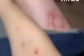 女子带狗就餐遭店家的猫抓咬致伤，当事人：报警后才带我去医院，老板：猫狗本就不和，1万元赔偿不能接受图片