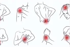 医生分享最全的人体疼痛对照表，不妨对照看看，你哪里出问题了？图片