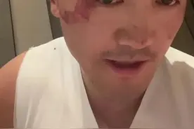 后续，武僧“一龙”被蒙面人打伤，怀疑是同门师兄弟，事后称意外图片