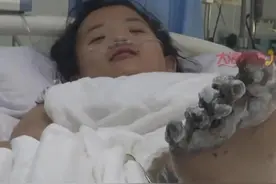 太恐怖！沈阳女孩充电玩手机被电击，各脏器受损，需要截肢图片