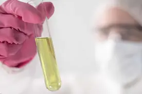 尿液颜色竟是健康的报警信号？医生：尿液出现这些颜色，需重视！图片