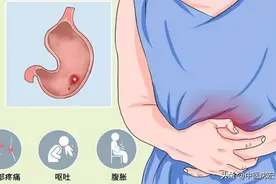 千年降气第一方，降胃气，健脾气，顺肝气，通大便 治疗胃炎老胃病图片