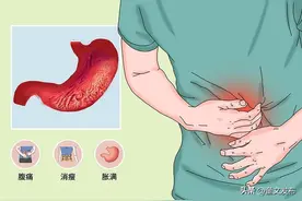 药店里不起眼的胃康灵胶囊，不止能柔肝和胃，还能治疗这5种病图片