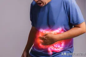 切掉的肠息肉，为什么还会复发？3个原因告诉你，别后知后觉图片