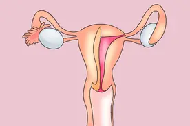 什么是阴挺？对身体健康有影响吗？需不需要治疗？女人早点了解图片