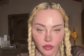 巨星麦当娜大胆晒亲吻视频！脸部僵硬明显整容，嘴唇超厚吓到粉丝图片