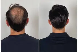 网友对假发的最大误解，闷热易掉不透气，真的是这样吗？图片