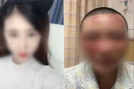 抓住黄金15秒，从浓硫酸魔爪下拯救你的脸图片