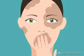 脸上有白白的一块是怎么回事图片