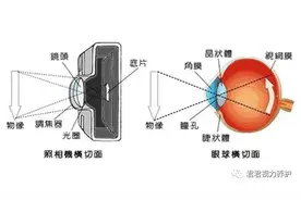 提升视力的小方法图片