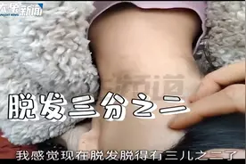 13岁少女秃顶令家长焦虑！这种症状常见于青少年，根源在这里→图片