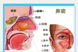 10个必知的鼻窦炎真相！别等鼻塞、头疼才后悔！图片