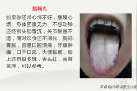 肝气一通、百病无踪，分享7个疏肝解郁中成药图片