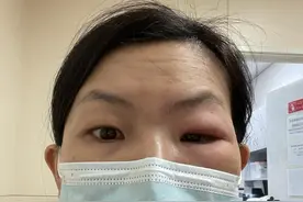终于找到正确的医生治疗我的眼眶蜂窝织炎：详细记录住院康复经历图片