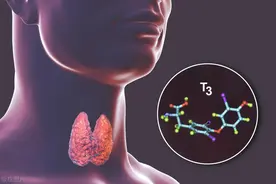 甲亢是如何引起的？甲亢由6个原因引起，早了解早预防图片