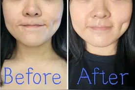 什么是热拉提？效果如何呢？图片