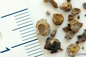 红色预警｜高温天气要警惕“尿结石”来袭图片