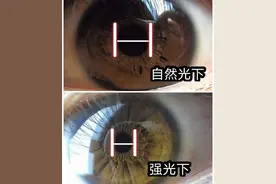 冻知识：一个人爱不爱你，看瞳孔反应就知道？图片