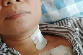 我是如何度过乳腺癌的手术治疗与化疗的图片