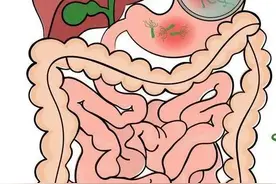 幽门螺杆菌，一定要“赶尽杀绝”吗？图片
