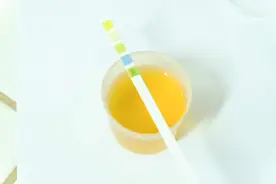 尿液发黄，异味重，或与这5种疾病有关，了解后，需对症治疗图片
