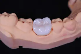 如果可以的话，你会选择种植还是全瓷牙图片