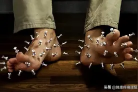 几个足部活动预防脚趾疼痛麻木图片