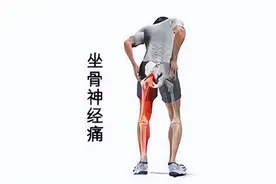 记住这几个方法可以有效缓解坐骨神经疼痛图片