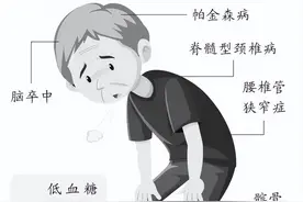 腿酸没劲，排查七个诱因 | 为了您的健康，我们的专家有话说图片