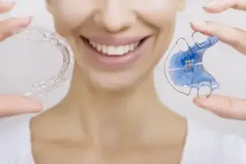 Really？牙齿矫正的方法不同，正畸的速度就不一样？图片