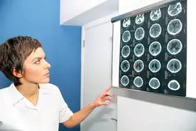 提醒：高血压出现这6种症状，是脑出血信号，有1个都不能疏忽大意图片