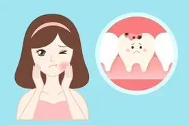拔了智齿脸会不会瘦图片