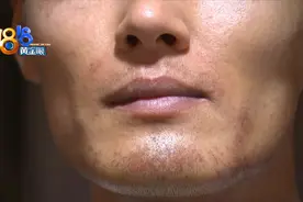 用脱毛膏脱胡子，涂上后疼得害怕图片