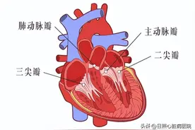 心脏瓣膜病是“换瓣”还是“修复”，看完你就懂了......图片