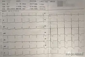 ST-T改变一定是冠心病？心肌桥也不少见图片