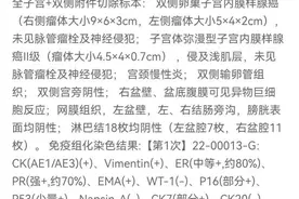 聊一聊我为什么会得卵巢癌？卵巢癌的初期症状有哪些是值得注意的图片