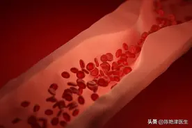 血脂高的人不能吃面条？提醒：若想稳定血脂，尽量远离这3种素食图片