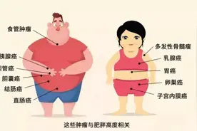 过度肥胖瘦不下来？代谢疾病缠身？微创减重手术了解一下图片