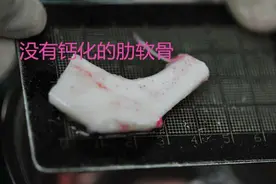 肋软骨钙化，还能隆鼻吗？三甲医生解读，求美者关心的4个问题图片