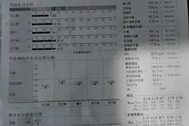我在透析时如何找到干体重的图片