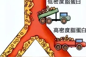 高脂血症危害大，中医辨证选方治疗效果好图片