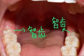 你的牙齿还好吗？图片