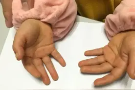 吃橘子会“中毒”么？图片