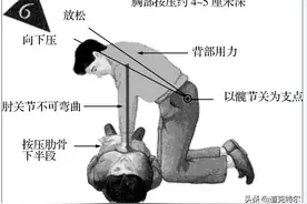每个人都必须学会心肺复苏的正常操作图片