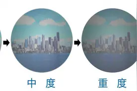 什么是白内障，它的症状是什么？图片