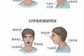 「杏林微科普」您知道什么是“口呼吸”吗？图片