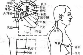 远离头痛“紧箍咒”图片