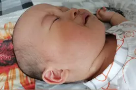 9个月宝宝幼儿急疹在家的自愈过程，高烧不退，到自己自愈图片
