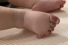 江苏宝宝小脚趾“90度劈叉”，妈妈复位7次失败，网友猜测太奇葩图片